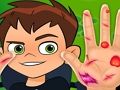 Leikur Ben10 handlæknir  á netinu