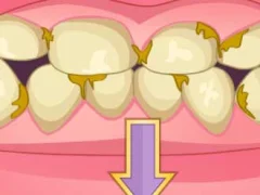 Leikur Bad Teeth Makeover á netinu