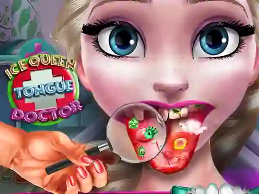 Leikur Ice Queen Tongue Doctor á netinu