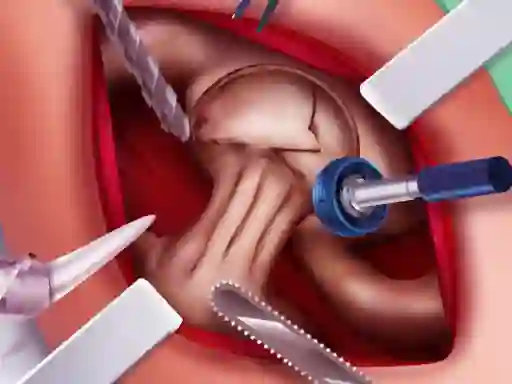 Leikur Princess Hips Surgery á netinu